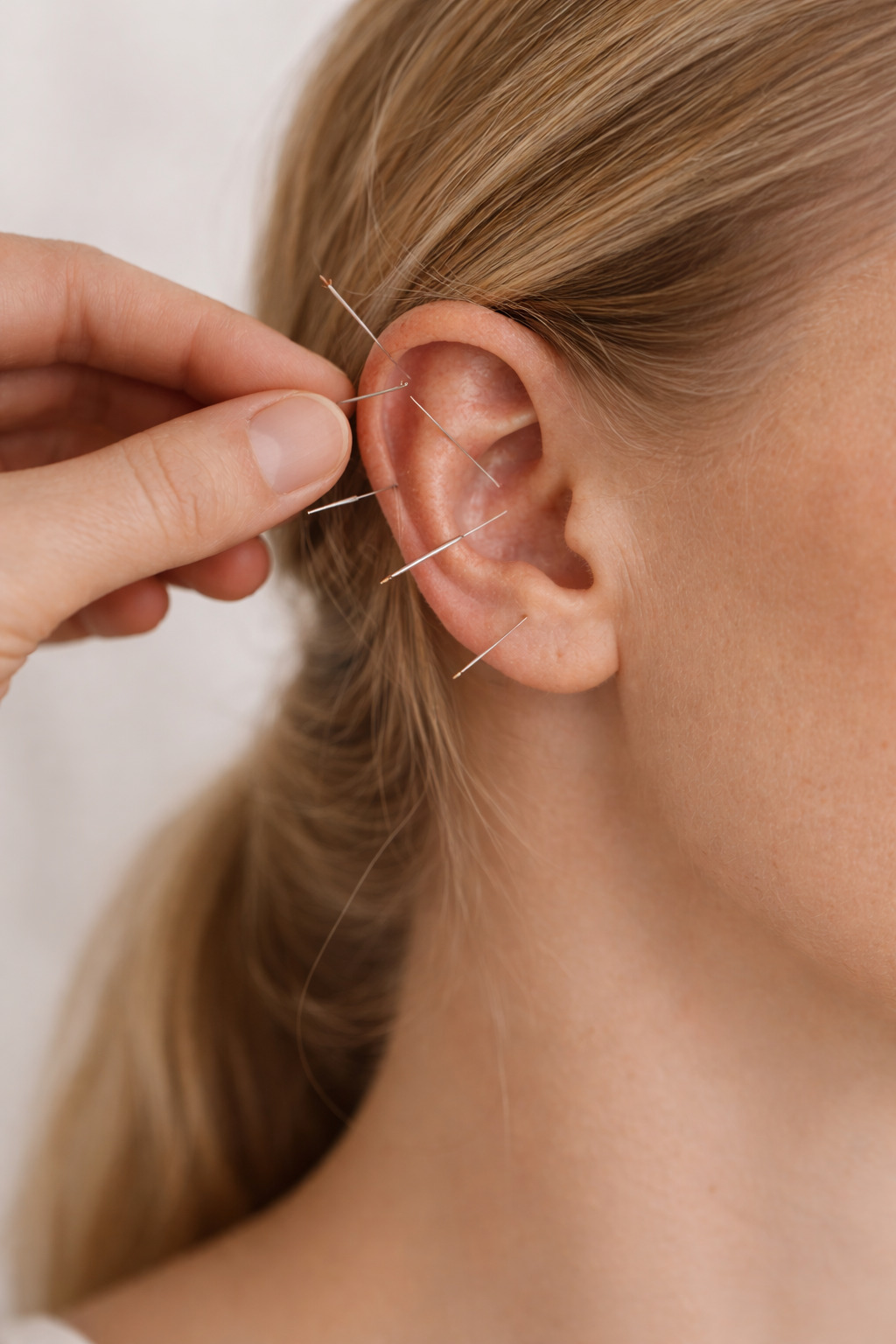 Аурикулотерапия — воздействие на активные точки уха